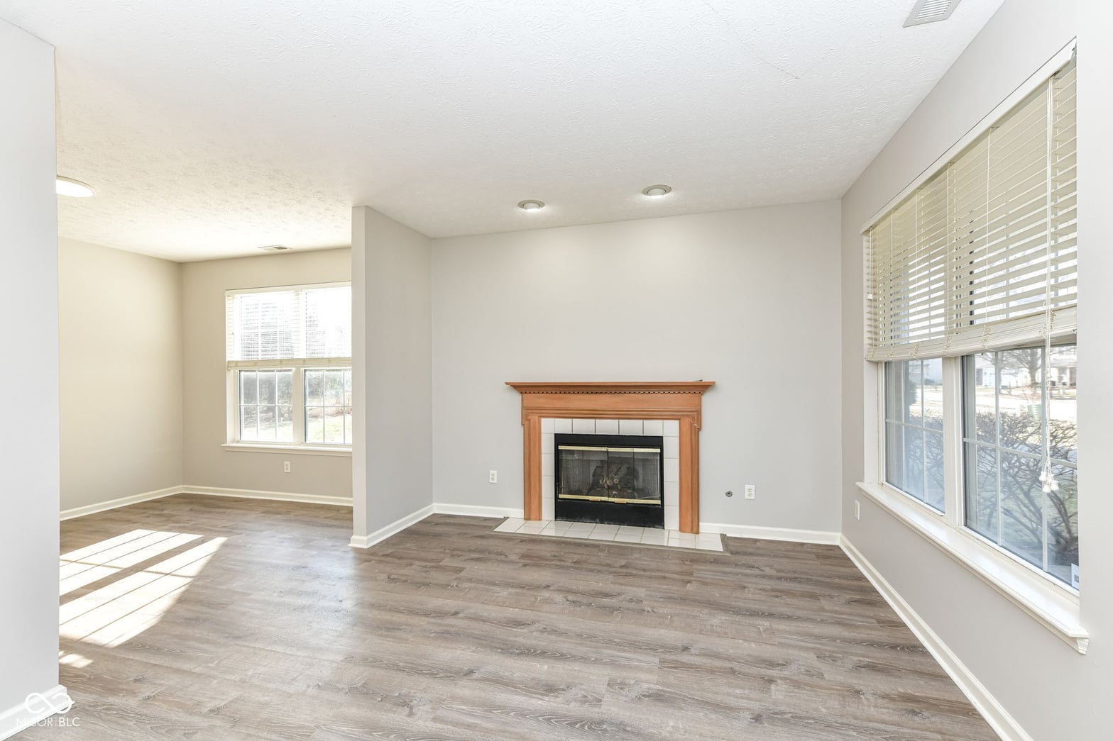Bright open living room with fireplace and abundant windows
